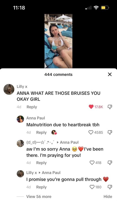 Anna Paul : r/AussieTikTokSnark